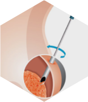 Anatomia Patológica (Biópsias e Espécimes Cirúrgicos)
