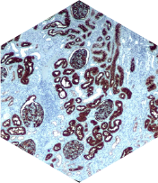 Exames Imunohistoquímicos
